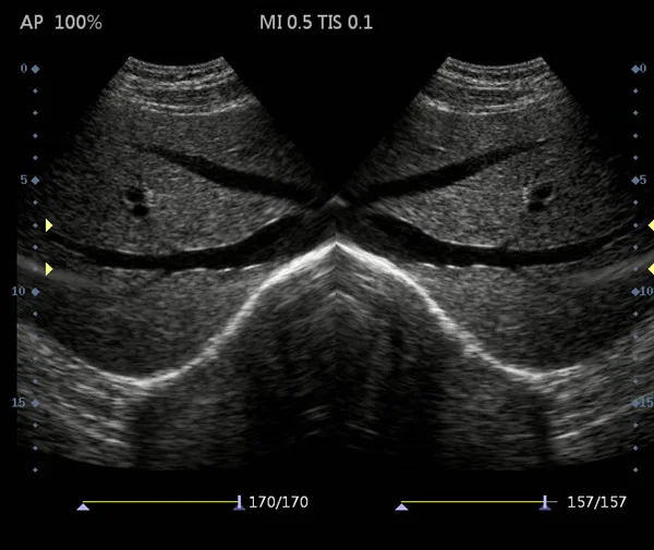 O super preto e branco portátil de b, cabeça convexa da ponta de prova da disposição de 3.5mhz, pode ser equipado com a ponta de prova do ultrassom de 6.5mhz yin
