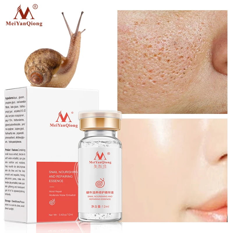 High Quality Snail 100% Pure Plant Extract Hyaluronic Acid Liquid Whitening Blemish Serum Ampoules Anti-acne Rejuvenation Serum