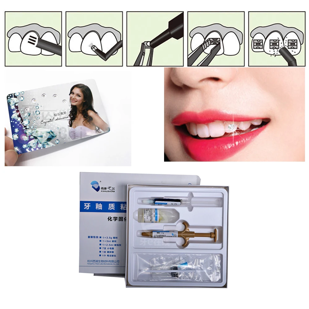 

Dental Adhesive For Tooth Gems Diamond Kit Glue Teeth Crystal Jewelry Ornament Self Cure Cement Bonding Soft Gel Orthodontic