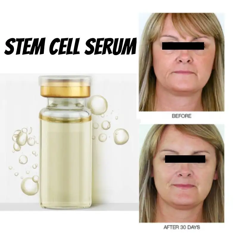 Stammzellen Serum Anti Aging Echt Stammzellen Kulturen Gesicht Serum Erhellen Verbessern Feine Linien Lifting Straffende Amid Essenz Haut