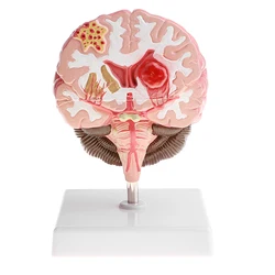 Anatomical Human's Brain Disease Pathological Model Medical Teaching Tool Lab Display Model Education Human's Brain Model