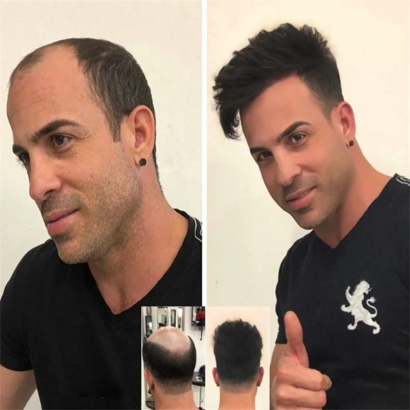 

Black Straight Remy Hair Toupee Men Natural Hair Wig for Men Toupee Men's Wig for Man Hairpiece Mens Hair Replacement System