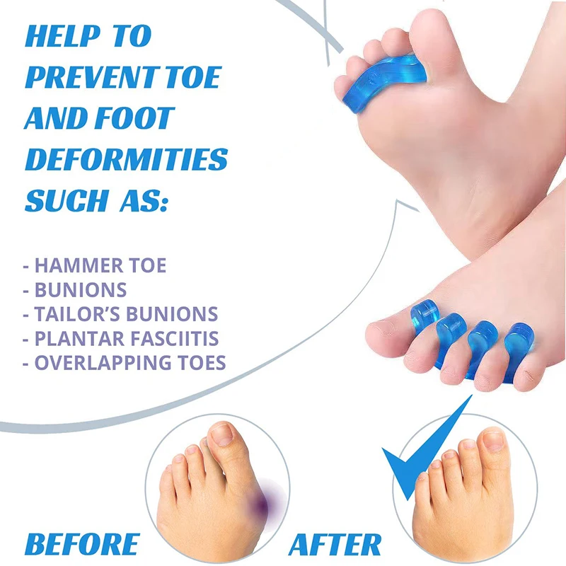 2 Pair Silicone Finger Toe Separators Hallux Valgus Bunion Correction Overlapped Toe Adjuster Protector Pedicure Pad Foot Care