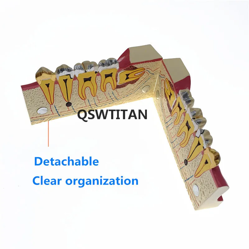 Choroby zębów zęby anatomii Model molowy przekrój rozkładu model w prawym dolnym rogu tylnej model zębów