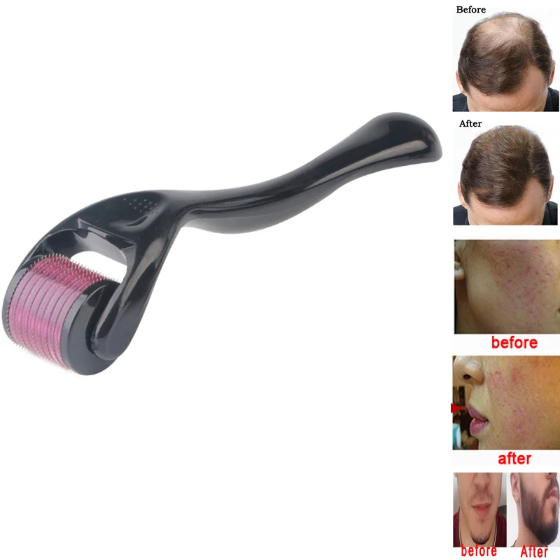 Rodillo Derma para el cuero cabelludo DRS 540 MTS, microaguja para el cuidado de la piel, crecimiento del cabello, tratamiento antipérdida de cabello, adelgazamiento y retroceso