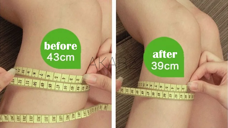 Akarz-زيت أساسي لفقدان الوزن ، حرق الدهون ، التبييض ، الخصر الرفيع ، الساق ، التخسيس #3