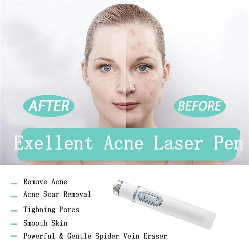 Acne Laser Pen Portable Wrinkle Removal Machine Soft Scar Dark Circles Remover Durable Blue Light Therapy Massage Relax Device