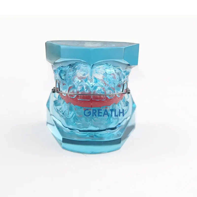 Dental Onderwijs Model Removable Model Orthodontische Model Met Retainer