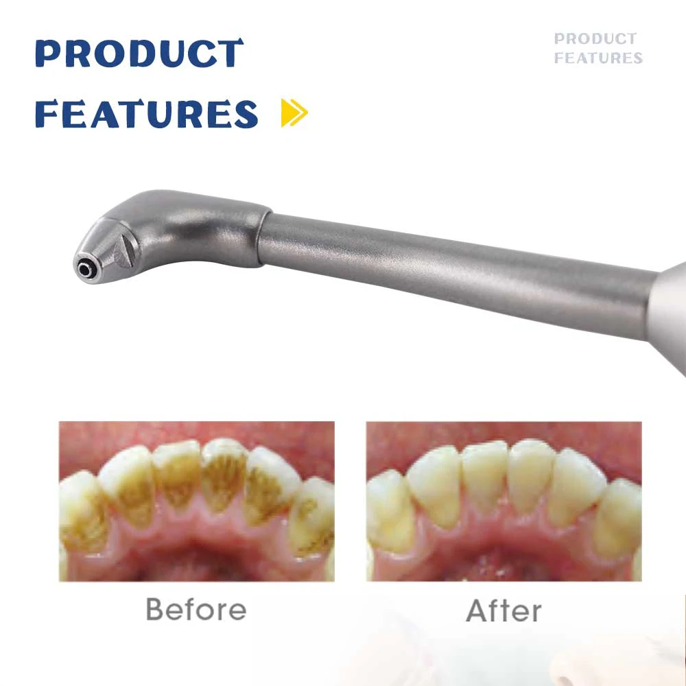 Стоматологическая клиника Интраоральная система полировки воздуха профи струйный анти-всасывающий гигиенический наконечник полировщик S * Тип быстроразъемный соединитель