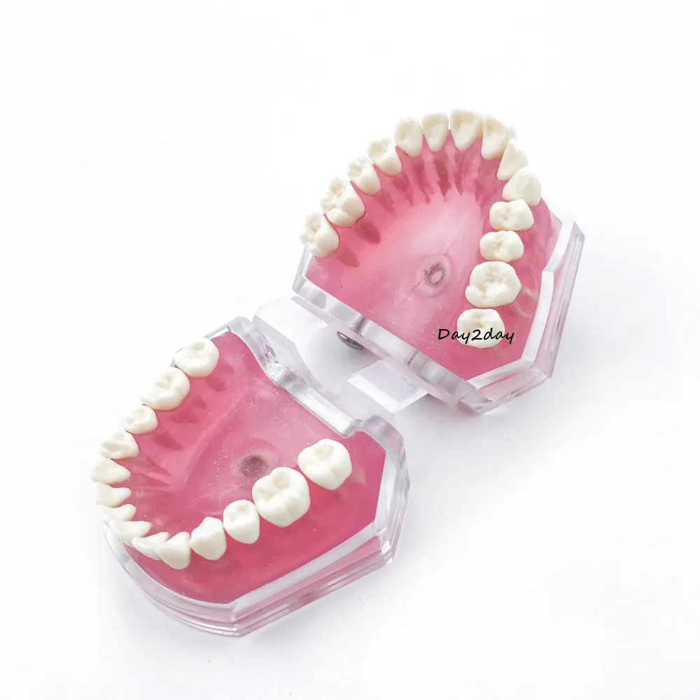 Dental Standard Model with Removable Teeth Dental Study Teach Teeth Model #7008