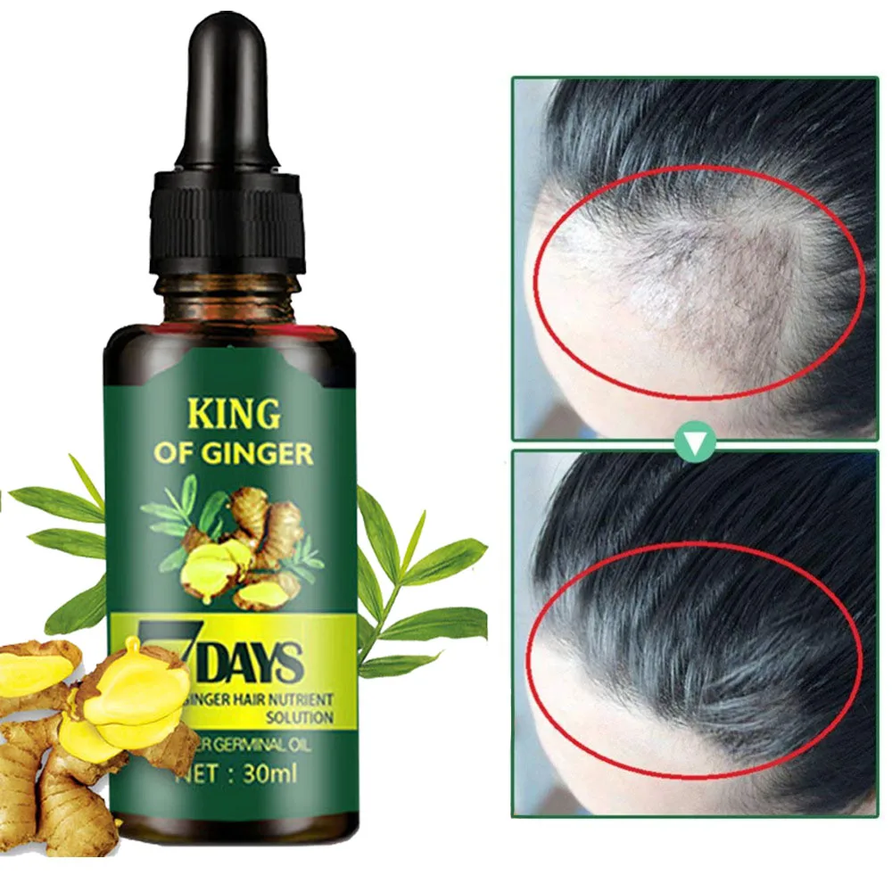 7 Day Ginger Hair Growth Essence Germinal Serum Essence Oil Natural Hair Loss Treatement Effective Fast Growth Hair Care 30ML