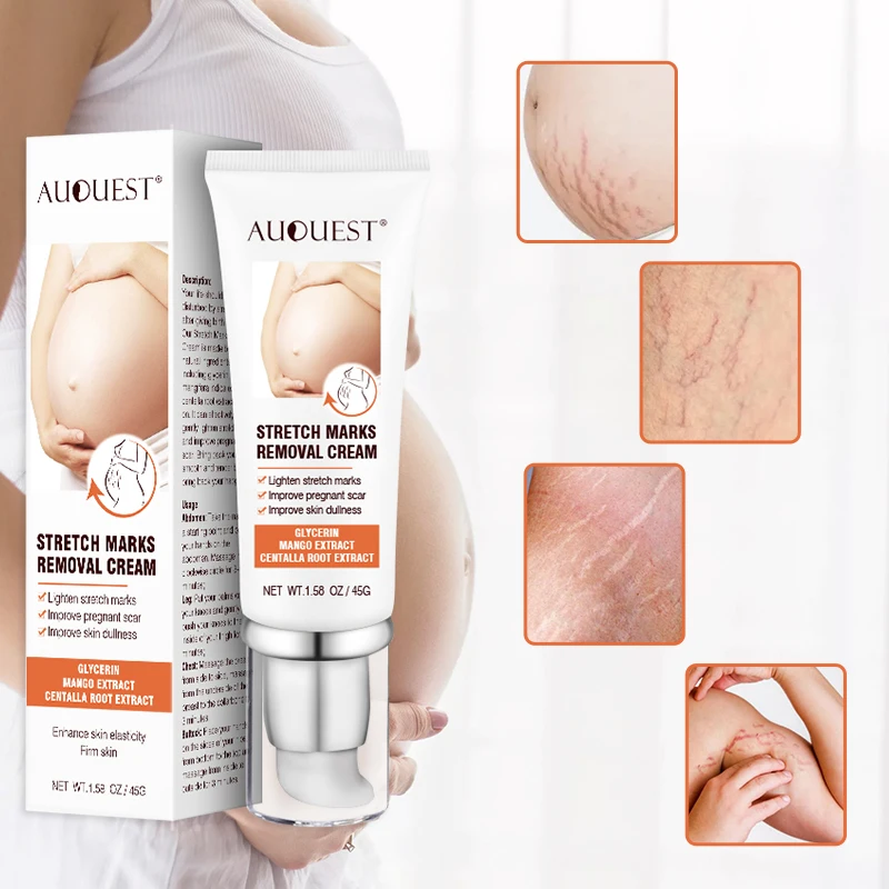 Stretch Marks Permanent Removal Cream Anti-Winkle Smooth Eliminate Swelling Marks Scars Anti Chafing Repair Firming Skin Care