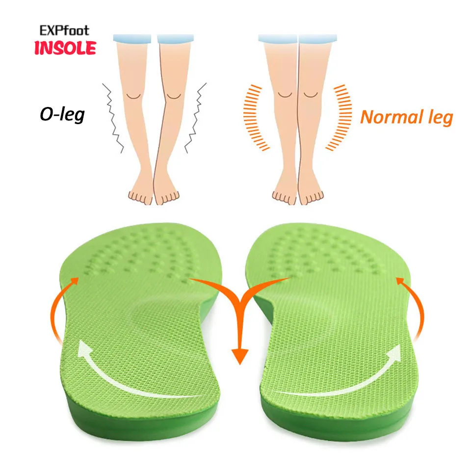 EXPfoot O/X-Leg Orthopedic Insoles Arch support insole corrigibil Bow Legs Valgus Varus Massaging Shoe pads Beauty Leg Feet Care