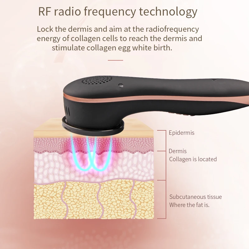 Massaggiatore facciale freddo freddo caldo 4 in 1 EMS RF radiofrequenza fotone ringiovanimento della pelle vibrazione sonora strumento dispositivo di bellezza