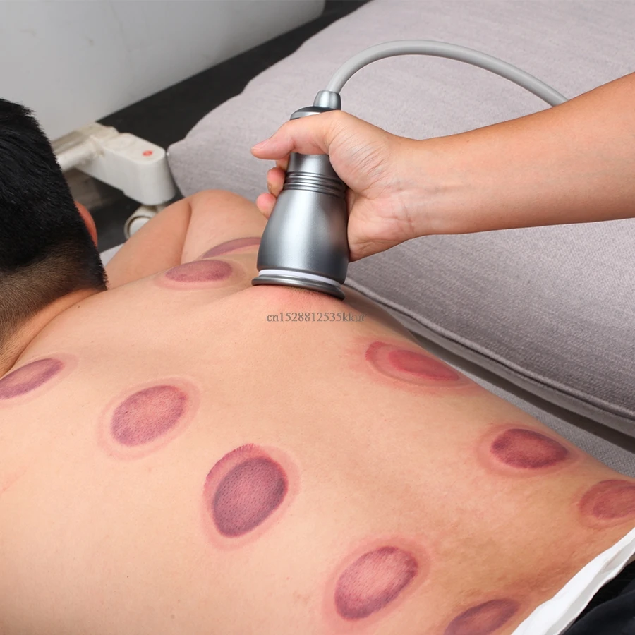 Electric Scraping Machine Gua Sha Ventosas Anti Cellulite Fat Burner Cupping Slim Massager Vibrating Meridian Dredge Instrument