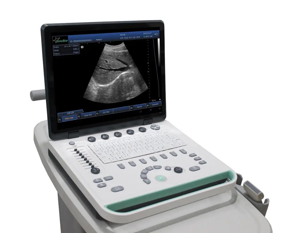 15 in LED screen notebook ultrasound free shipping