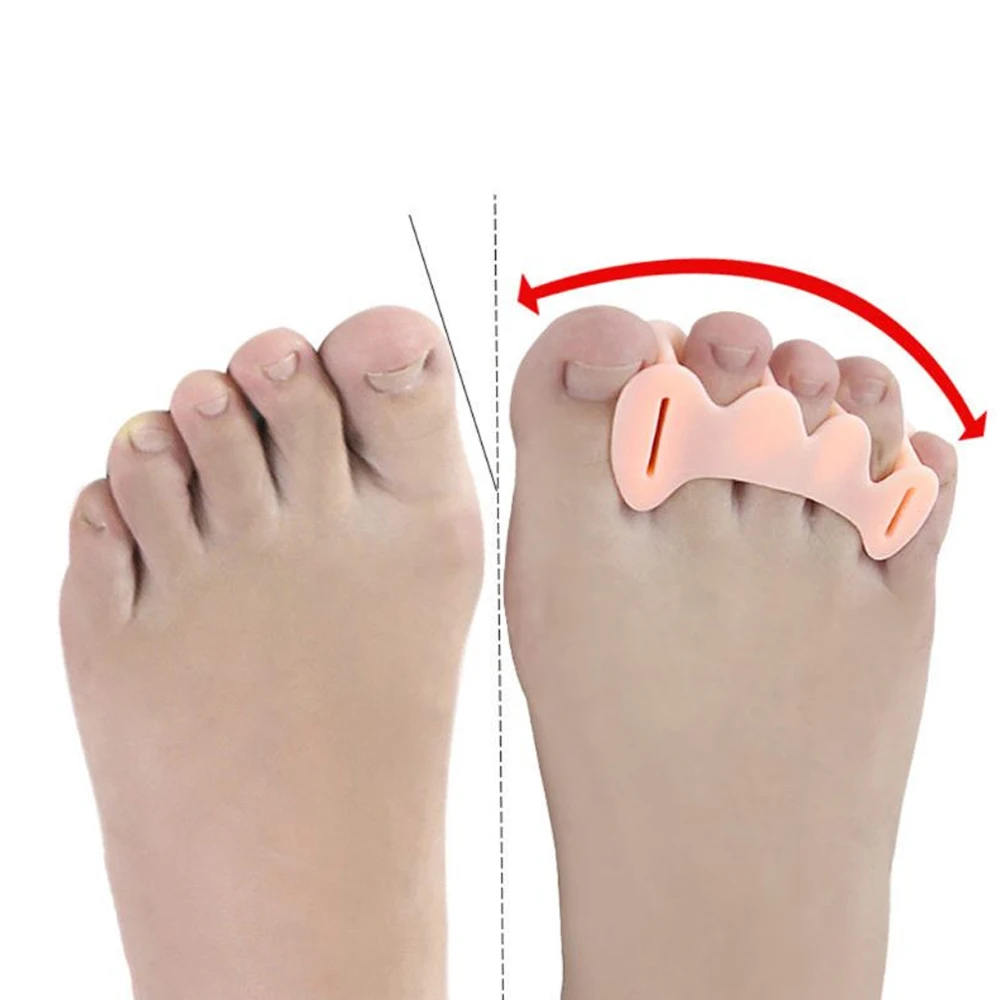 1 PairThree-hole Chain Thumb Valgus Corrector for Day and Night Wearable Big Toe Foot Bone Toe Separator