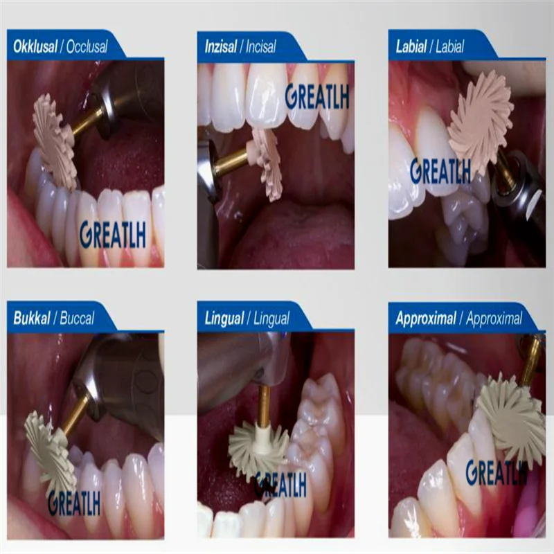 Polerowanie zębów Disc Kit Spiral Flex Brush Burs do kompozytów cyrkonia ceramiczna polerka wiertła dentystyczne