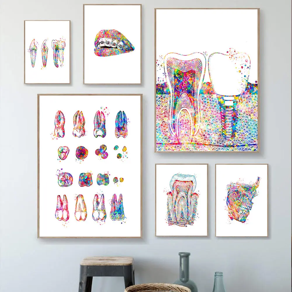 Tooth Implant Wall Art Canvas Painting Posters Prints Dental Dentist Anatomy Medical Wall Pictures Hospital Clinic Home