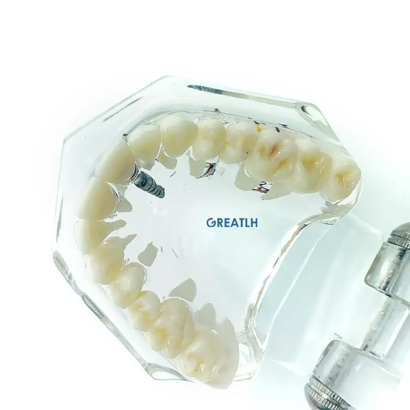 Teeth Model Dentistry Products Pathologies Repair Model with Nerve