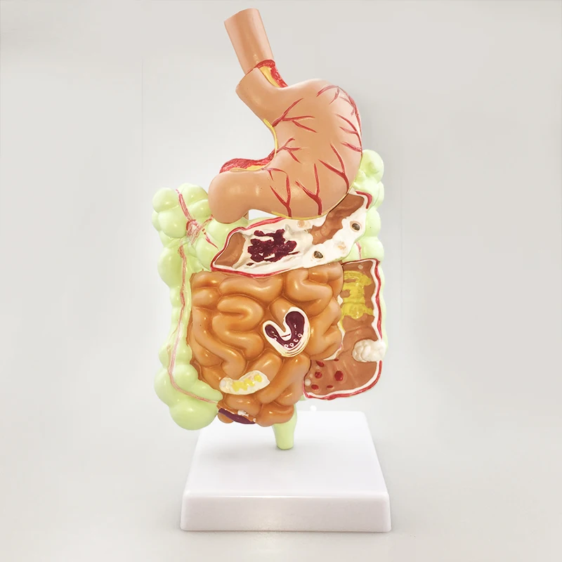 Human Digestive system Stomach anatomy model the large intestine Cecum rectum dental teaching supplies