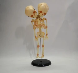 Fetal fetus Skeleton teaching educational Model Double Head Baby Skull Skeleton Anatomy model