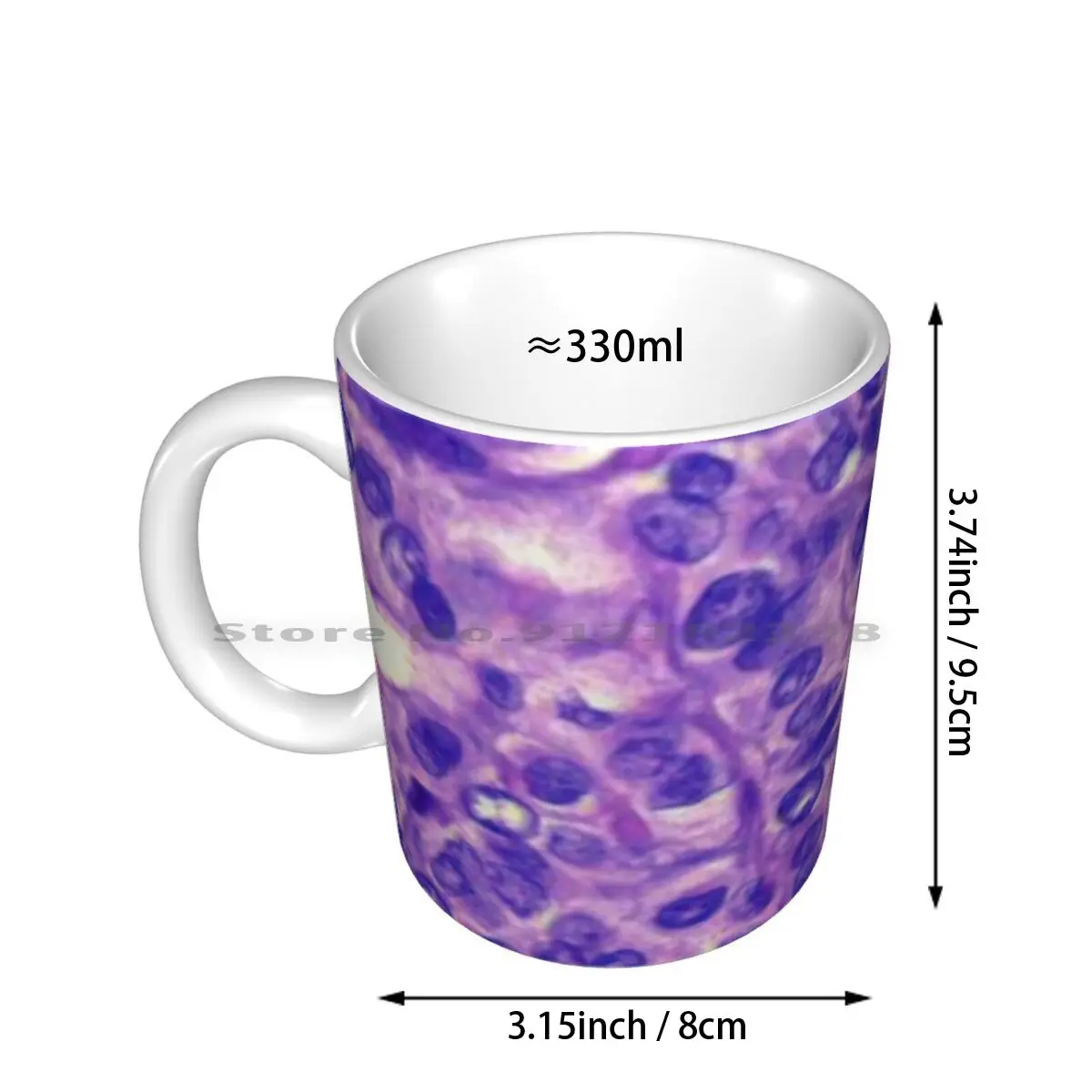 Papillary Carcinoma Ceramic Mugs Coffee Cups Milk Tea Mug Cancer Carcinoma Papillary Thyroid Student Histology Thyroid