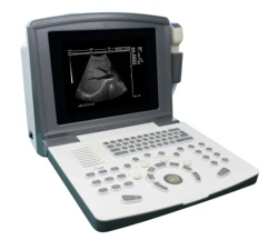 10 Inch LED Laptop Portable B Ultrasound Scanner Echo Machine