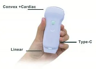 Wireless Ultrasound Probe for Android IOS Apple Google Play Windows Systems 3-in-1 Double Heads 128 Elements Color Doppler Probe