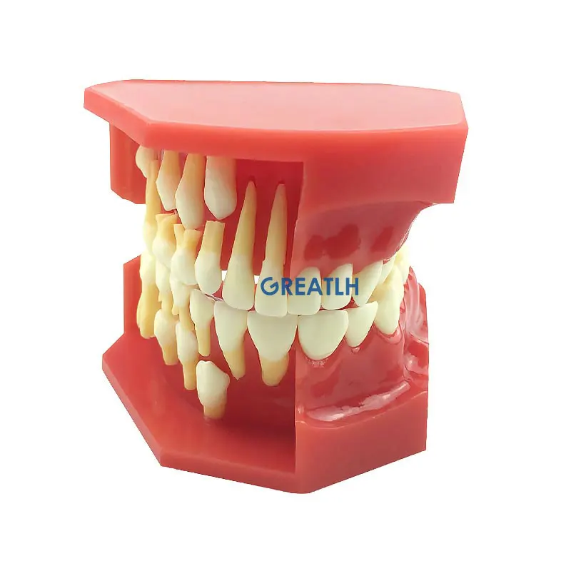 Dental Children 's Deciduous Teeth Replacement Model Milk Permanent Teeth Alternately Display Model Oral Communication Model
