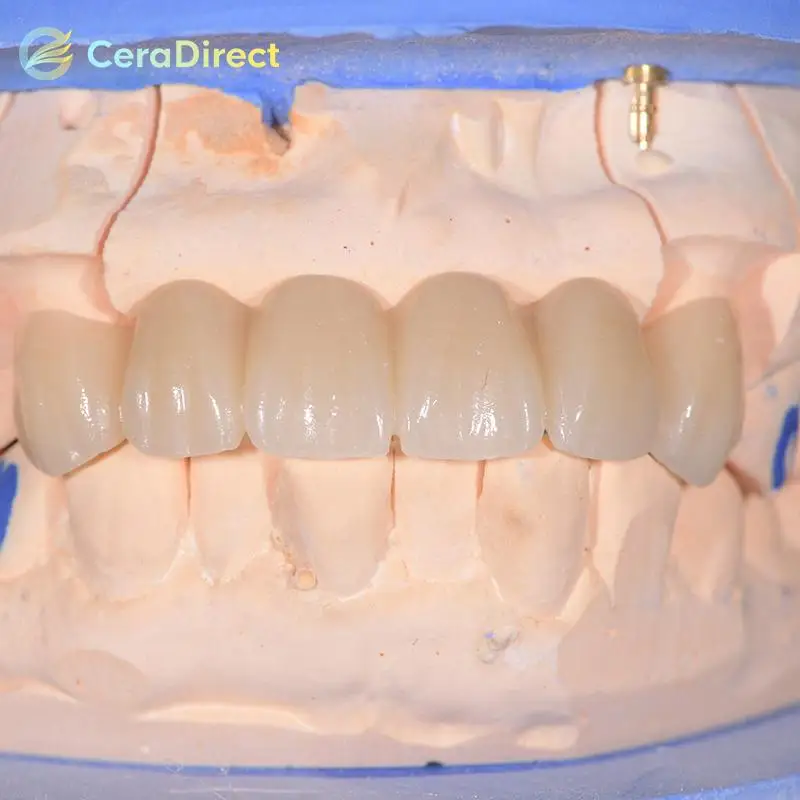 Ceradirect 3D-Pro Mehrschichtiges Zirkonoxid-AG-System (71 mm) – für Dentallabor CAD/CAM