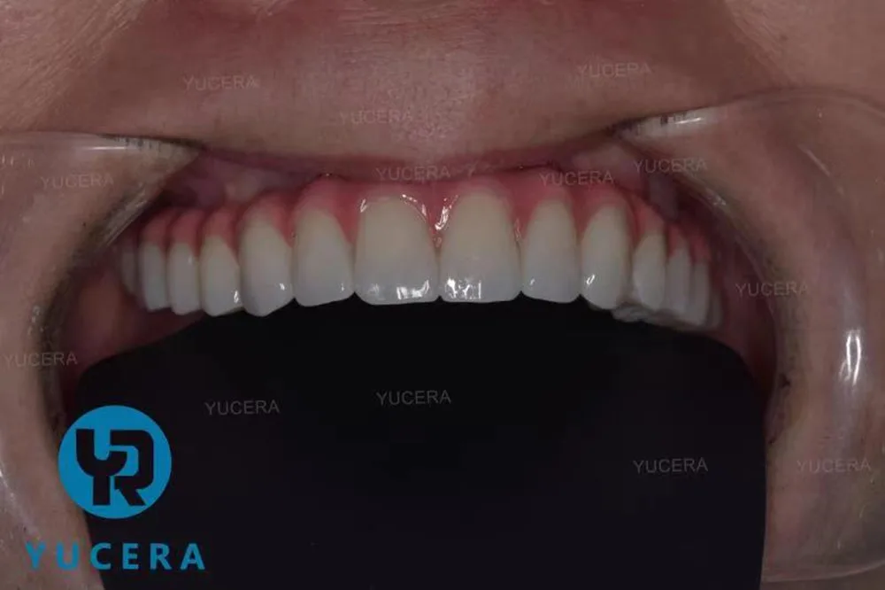 Yucera 3D plus dental Multilayer zirconia block cad /cam system for lab open system 98 mmX16mm