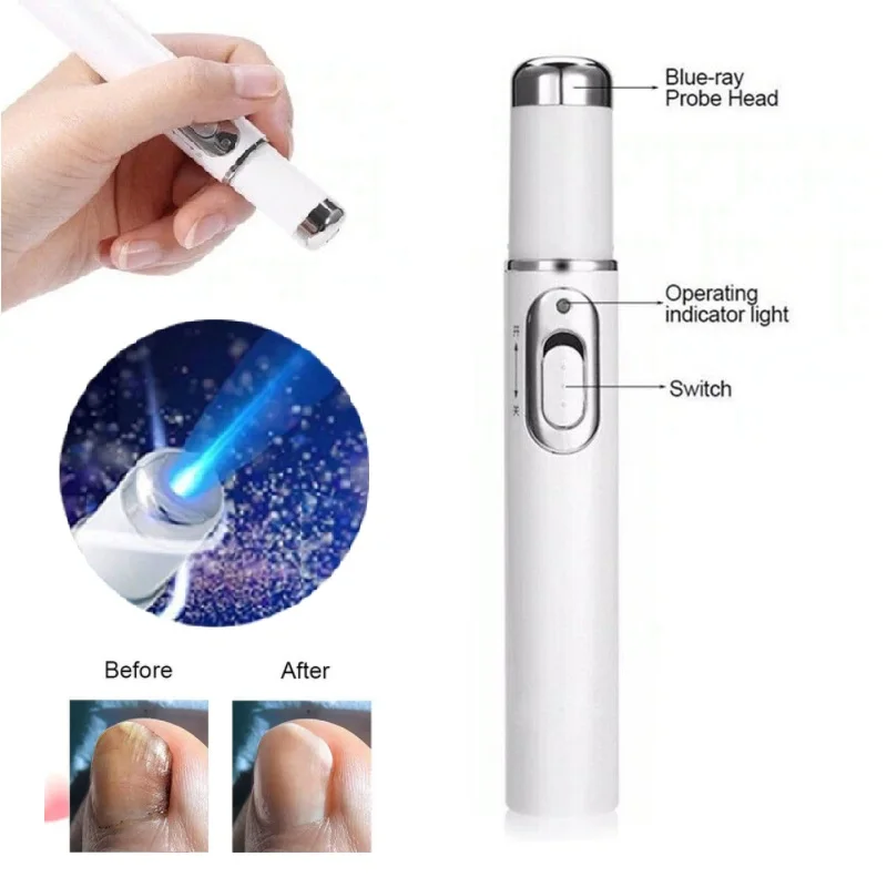 Hot Nail Fungal Pen Anti Fungus Blue Light Laser Pen Onychomycosis Painless Nail Repair Pen Nail Care Repair Serum Free Shipping