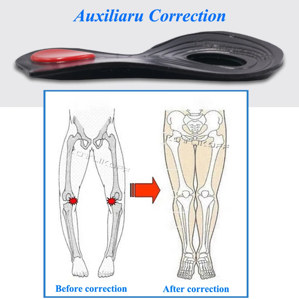 Orthopedic O/X-Leg Legs Relieve Insoles Silicone Soft Self-adhesive Corrector Valgus Varus Relieve Pain Massage Foot Care Insert image 4