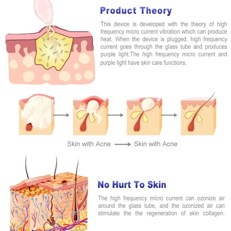 المهنية المحمولة عالية التردد آلة الوجه عصا 4 في 1 إزالة حب الشباب والعناية بالبشرة جهاز المنزل سبا الوجه أدوات التجميل الجلد