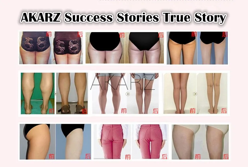 Akarz-زيت أساسي لفقدان الوزن ، حرق الدهون ، التبييض ، الخصر الرفيع ، الساق ، التخسيس #4