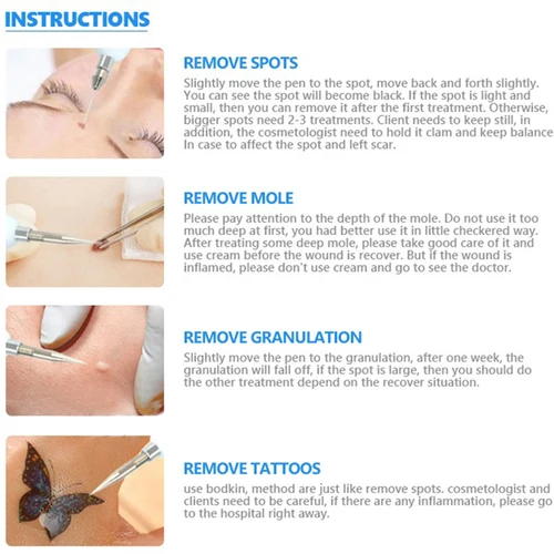 Imagen 2 del producto Bolígrafo de Plasma láser, repuesto de punta de aguja para eliminar manchas de la piel, máquina de eliminación de tatuajes, Topo, herramienta para cuidado de la piel facial, 10 Uds./50 Uds.agujas plasma pen,agujas para