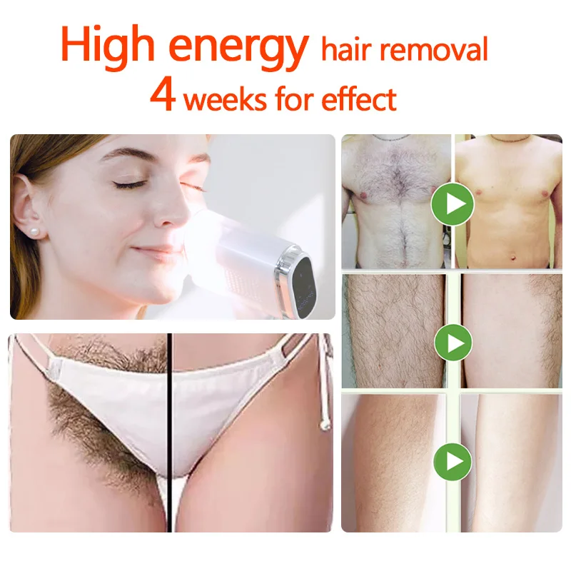 Osenyuan T023C Newest Sapphire Permanent Hair Removal  Skin Sensing Technology IPL Hair Removal Ice Painless Epilator For Women