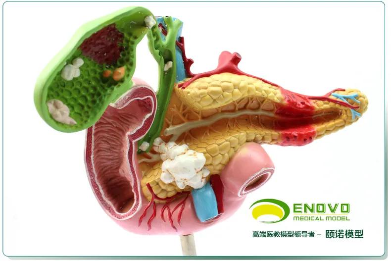 1:1 Life Size  Human Pancreatic Duodenal Gallbladder Pathology Anatomy Model Surgical Digestive System Model  Medical Supplies