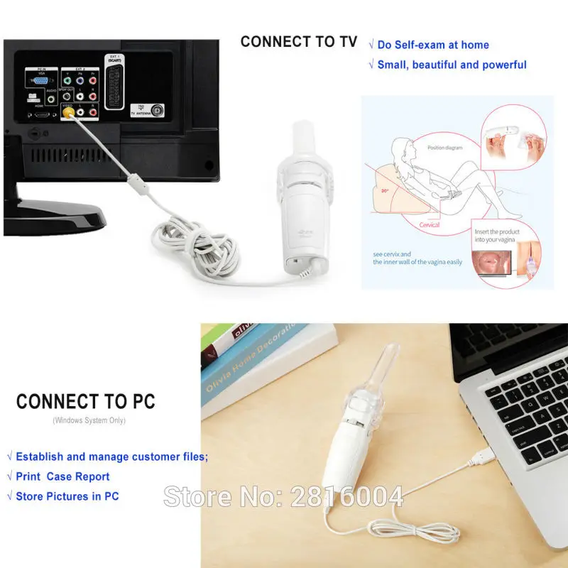 Portable Digital Video Electronic Mini Colposcope FA2 3000 000 Pixels with Display Screen Sunny Medical Miniscope Suit SEYES