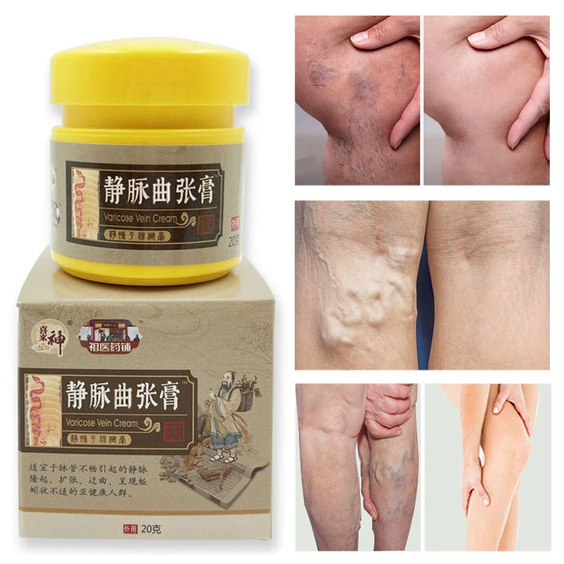 

Varicose Vein Treatments Cream Effective Relieve Legs Dilated Vasculitis Phlebitis Natural Formula Ointment For Varicose Veins