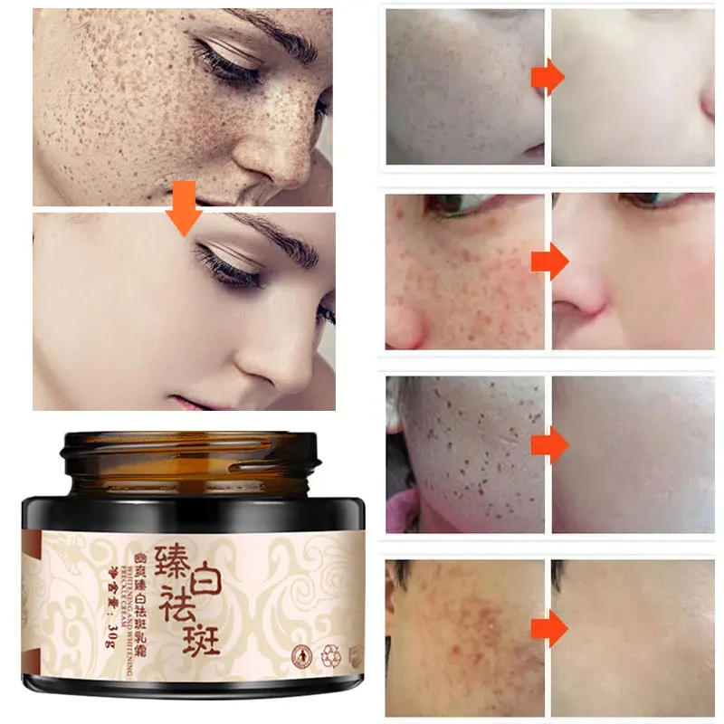 Remove Black Spots Face Cream Facial Care Brighten Skin Whitening Nourish Facial Skin Mild Potent Fade Spots Hyaluronic Acid 30g