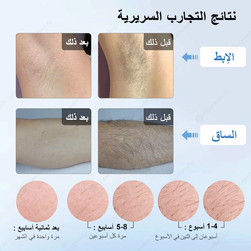 Melsya Laser Hair Removal T4 Home Depilador Machine Painless Laser Electric Ipl Pubic Facial Hair Removal Malay Epilator