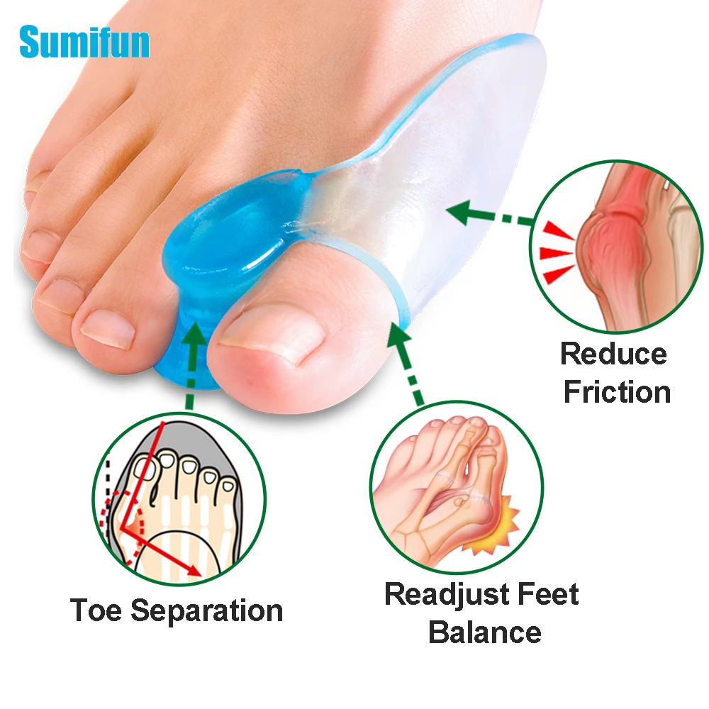 2Pcs Blue Silicone Gel Toe Separator Thumb Separator Overlapping Relief  Hallux Valgus Corrector Thumb Bunion Spacers Foot Care