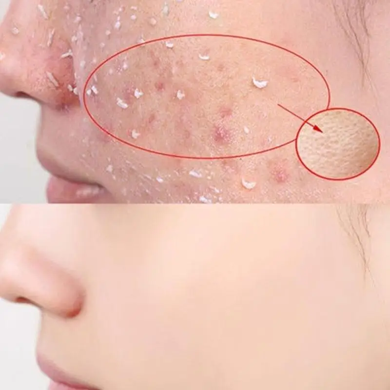 100ml esfoliante peeling gel pepino/papaia/gel de coco dead hidratante gel de remoção para rosto rosto esfoliante pele corpo r7y3