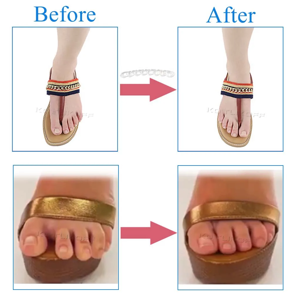 Self-adhesive Gel Non-slip Foot Patch Anti-wear Silicone Crystal Women High Heel Shoe Sticker Cushion Pad Foot Hind Care