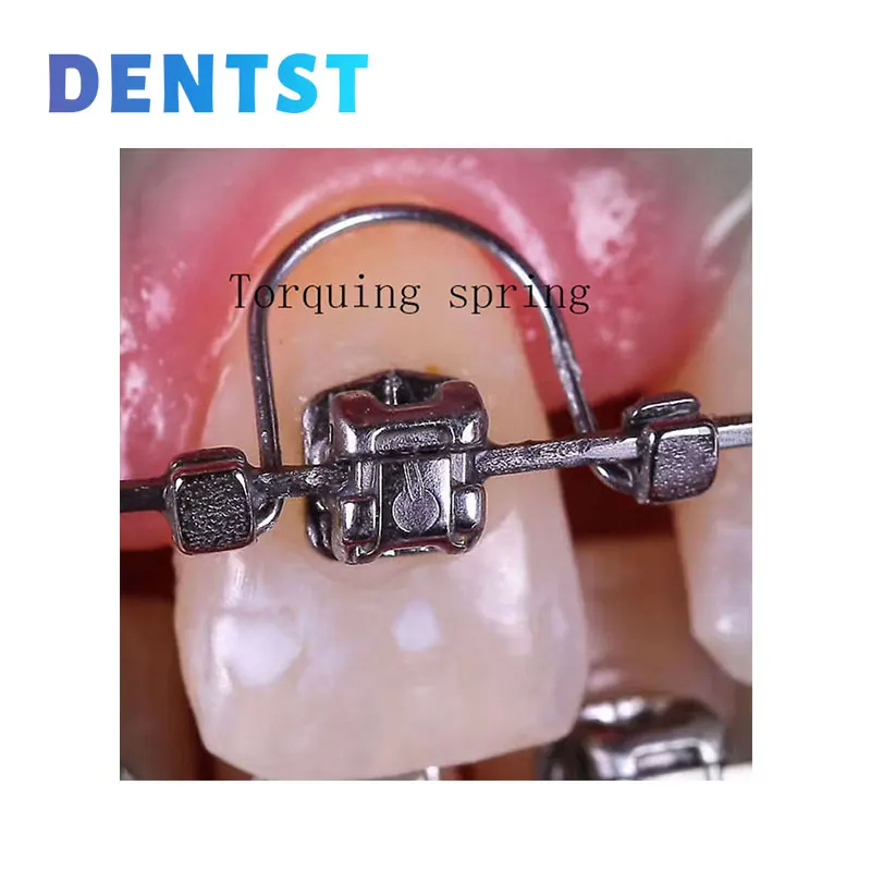 10Pcs/Bag Dental Torqueing Spring Orthodontic Front Torque Spring Auxiliar de Torque Warren Spring for Bracket Archwire