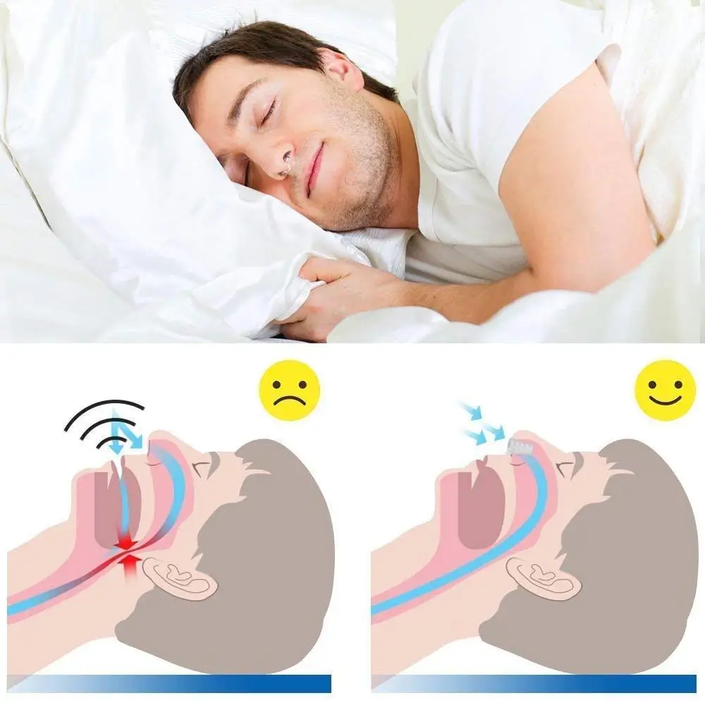 Anti Snoring Devices 4 Snoring Stopper Nasal Dilators-1 Anti Snoring nose clip Mouthpiece Sleep Mouth Guard Snore Stopper Set