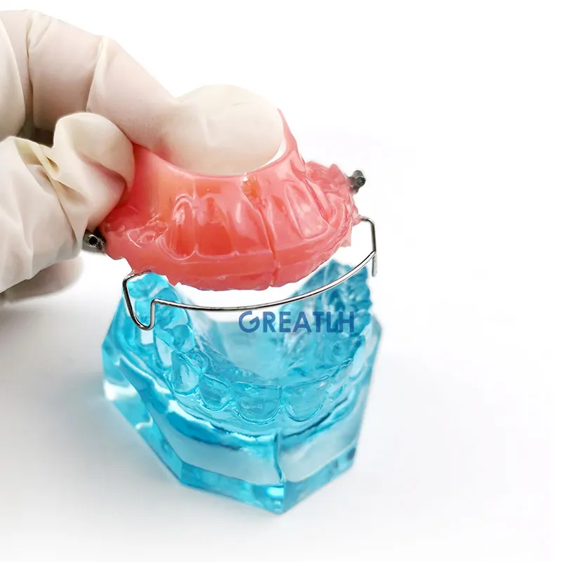 Dental Onderwijs Model Removable Model Orthodontische Model Met Retainer
