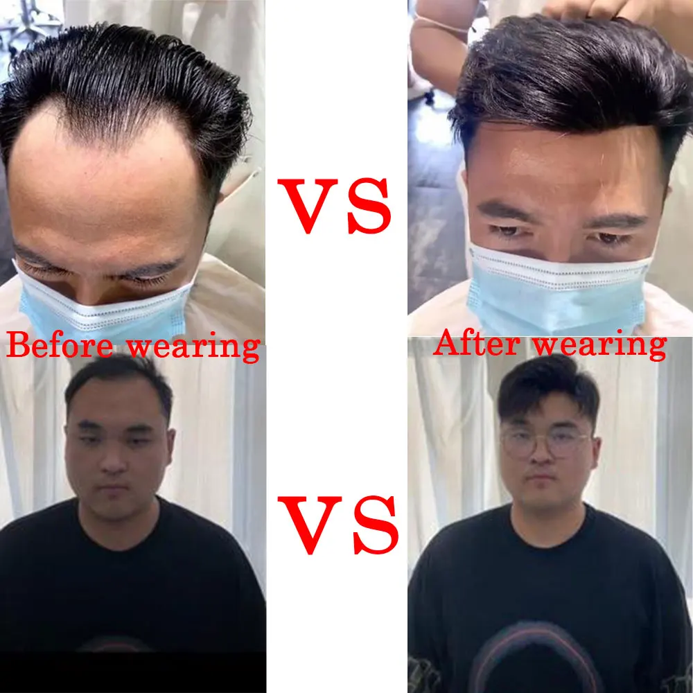 Men's Forehead Frontal V Style Hair Piece V Loop Front Hairline Wig With Tapes For Men Remy Hair Replacement System